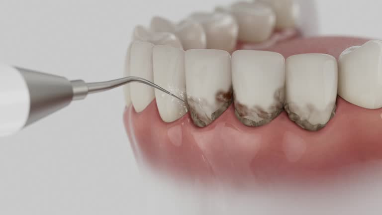 Trusted Wisdom Tooth Removal service in Paris, TN - Dentist Open Now